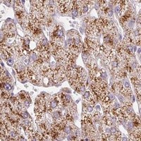 HPA IHC Liver — EHHADH