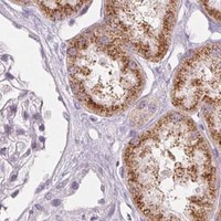 HPA IHC Kidney — EHHADH