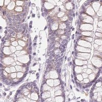 HPA IHC Colon — EHHADH