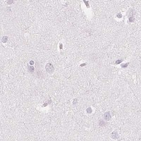 HPA IHC Cerebral cortex — EHHADH