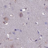HPA IHC Cerebral cortex — COL4A3