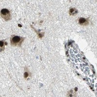 HPA IHC Cerebral cortex — SMARCA4