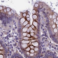 HPA IHC Colon — LOXL1
