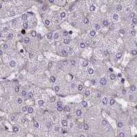HPA IHC Liver — LOXL1