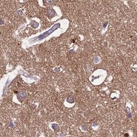 HPA IHC Cerebral cortex — MFSD12