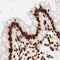 HPA IHC Colon — CTBP1