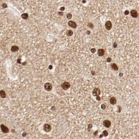 HPA IHC Cerebral cortex — CTBP1