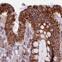 HPA IHC Colon — COX17
