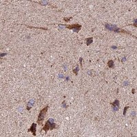 HPA IHC Cerebral cortex — COX17