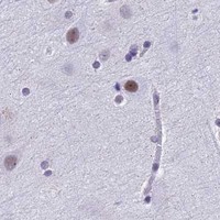 HPA IHC Cerebral cortex — ASH2L
