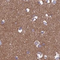 HPA IHC Cerebral cortex — IL21R