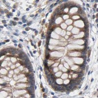 HPA IHC Colon — HDAC6