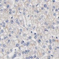 HPA IHC Liver — HDAC6