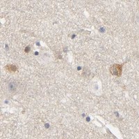 HPA IHC Cerebral cortex — HDAC6