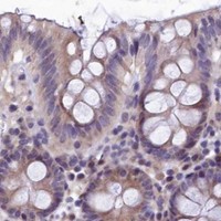 HPA IHC Colon — SLC39A6