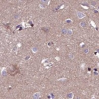 HPA IHC Cerebral cortex — SLC39A6