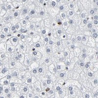 HPA IHC Liver — HSF1