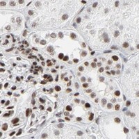 HPA IHC Kidney — HSF1