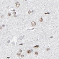 HPA IHC Cerebral cortex — HSF1