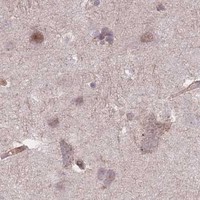 HPA IHC Cerebral cortex — PLD1