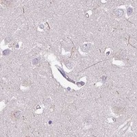 HPA IHC Cerebral cortex — CXCR5