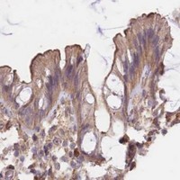 HPA IHC Colon — CLCF1