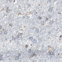 HPA IHC Cerebral cortex — RELA