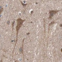 HPA IHC Cerebral cortex — PIK3R1