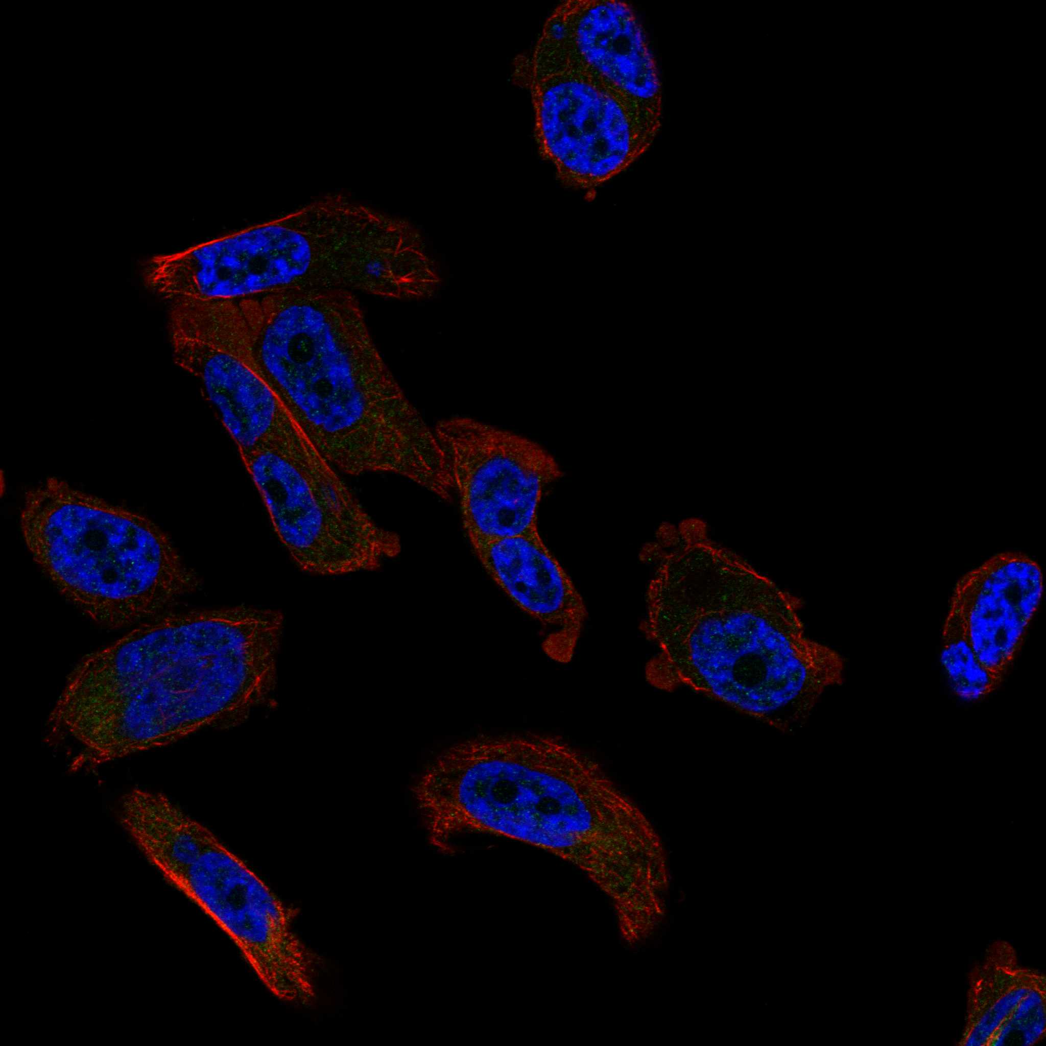 Subcellular QTRT1 The Human Protein Atlas