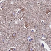 HPA IHC Cerebral cortex — NDUFB9