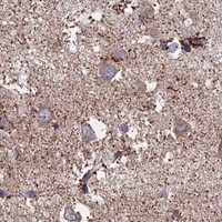HPA IHC Cerebral cortex — WDR83