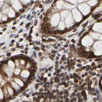 HPA IHC Colon — RANGAP1