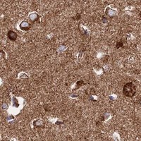 HPA IHC Cerebral cortex — CHCHD3