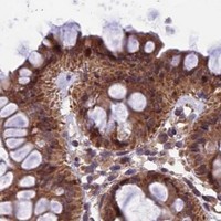 HPA IHC Colon — CYP2R1