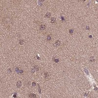 HPA IHC Cerebral cortex — CYP2R1