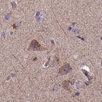 HPA IHC Cerebral cortex — ECSIT