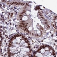 HPA IHC Colon — SF3B3