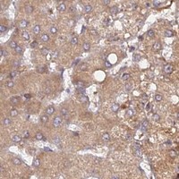 HPA IHC Liver — CCT6A