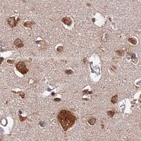 HPA IHC Cerebral cortex — CCT6A