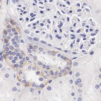 HPA IHC Kidney — ERBB2