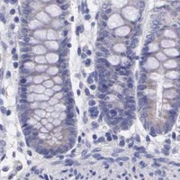 HPA IHC Colon — SLITRK4