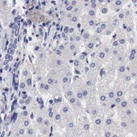 HPA IHC Liver — SLITRK4