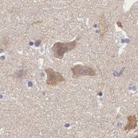 HPA IHC Cerebral cortex — SLITRK4