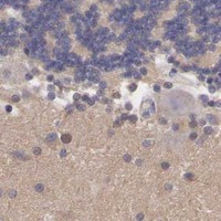 HPA IHC Cerebellum — SLITRK4