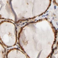 HPA IHC Thyroid gland — ANXA7