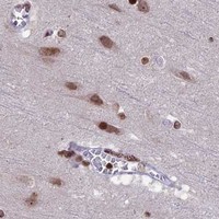 HPA IHC Cerebral cortex — TET2