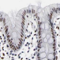 HPA IHC Colon — ARNT