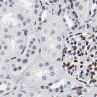 HPA IHC Kidney — ARNT