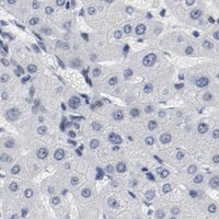 HPA IHC Liver — ARNT