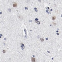 HPA IHC Cerebral cortex — ARNT